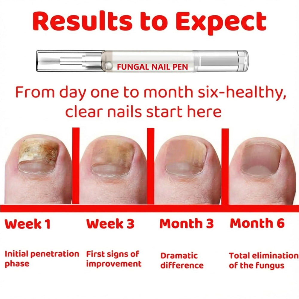 JONKEYPENY pen improves nail appearance with smoother texture and shine.