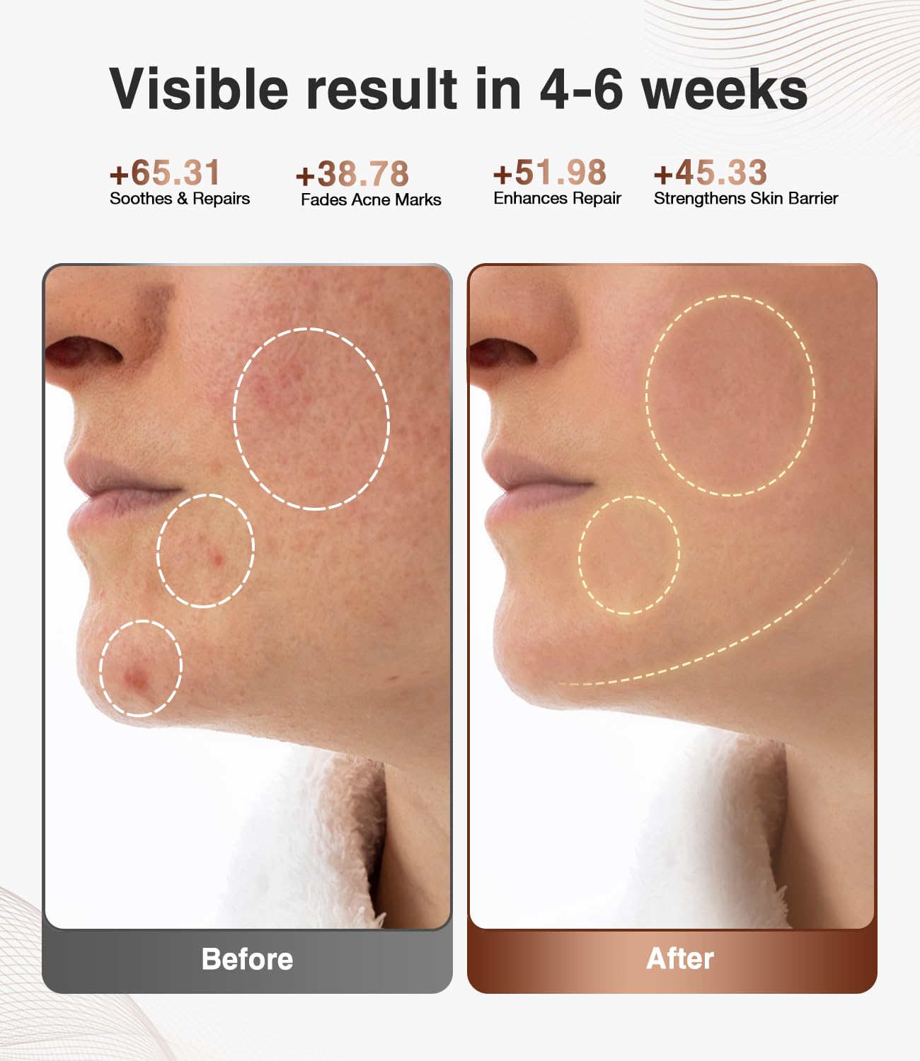 JOVS 4D mask remote control and timer for hands-free sessions