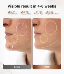 JOVS 4D mask remote control and timer for hands-free sessions