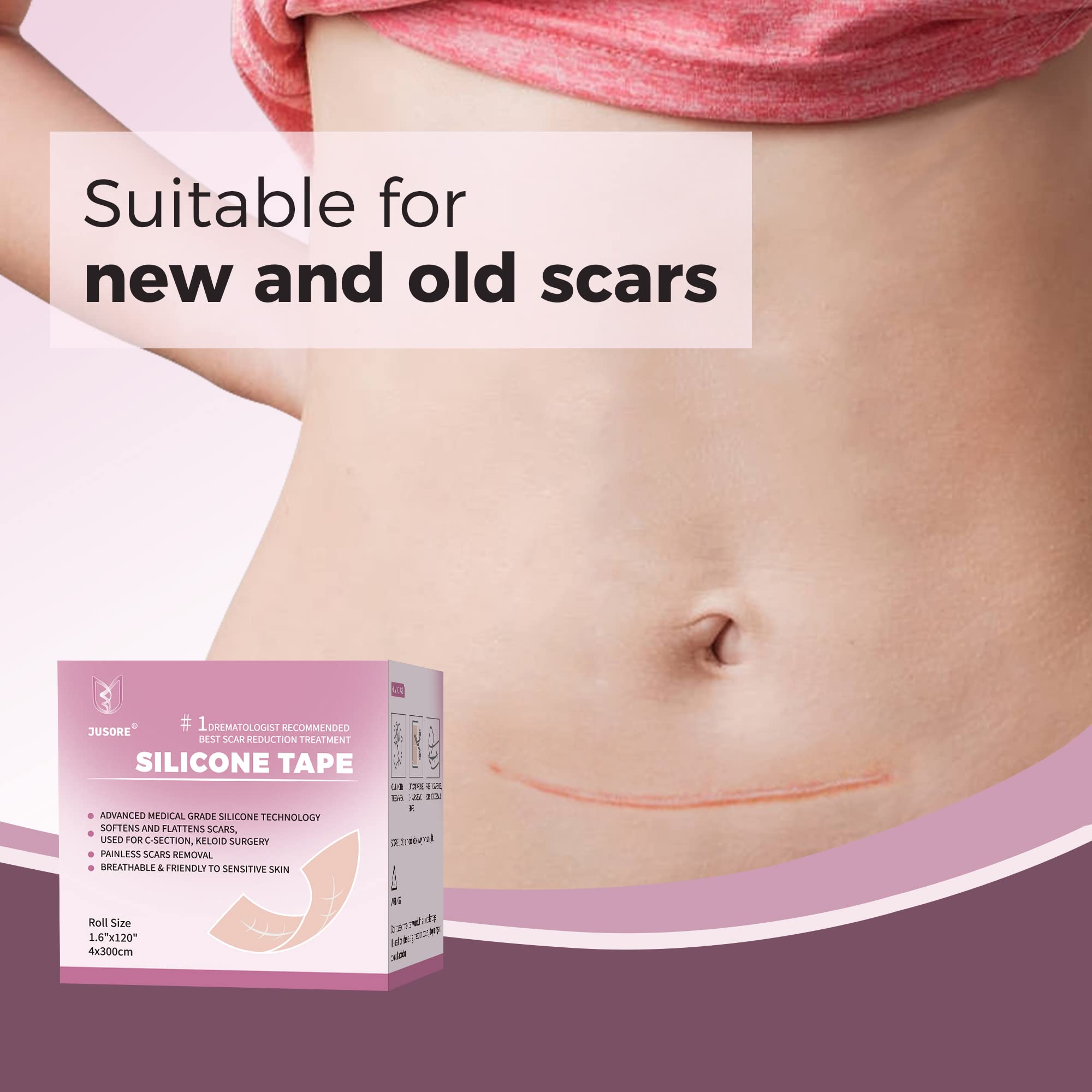 JUSORE aplicacion sin dolor para cicatriz, relieve suave de incomodidad