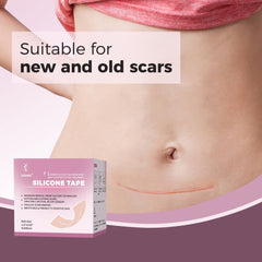 JUSORE aplicacion sin dolor para cicatriz, relieve suave de incomodidad