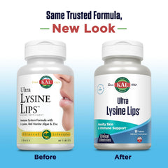 Close-up of KAL Ultra Lysine Lip Tablets capsules highlighting texture for daily use