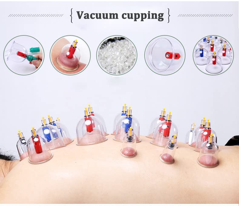 Kangzhu cupping set in use demonstrates practical home wellness routine.