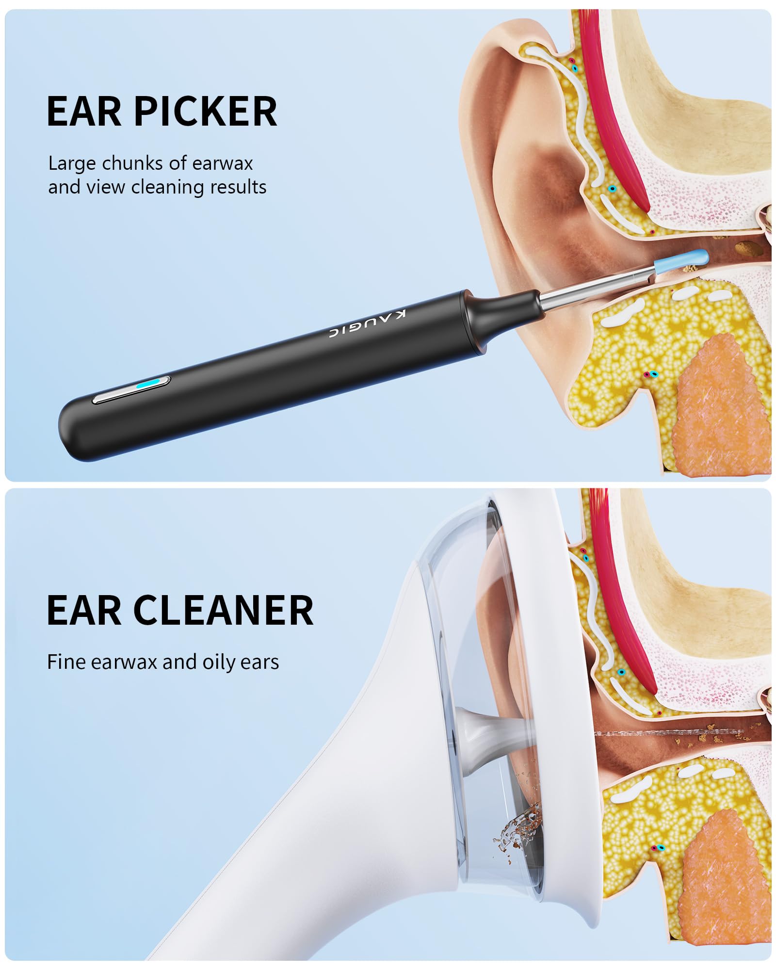 KAUGIC ear wax camera with 360-degree lens and LEDs provides clear visibility of the ear canal.