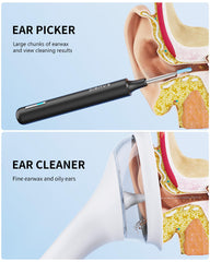 KAUGIC ear wax camera with 360-degree lens and LEDs provides clear visibility of the ear canal.