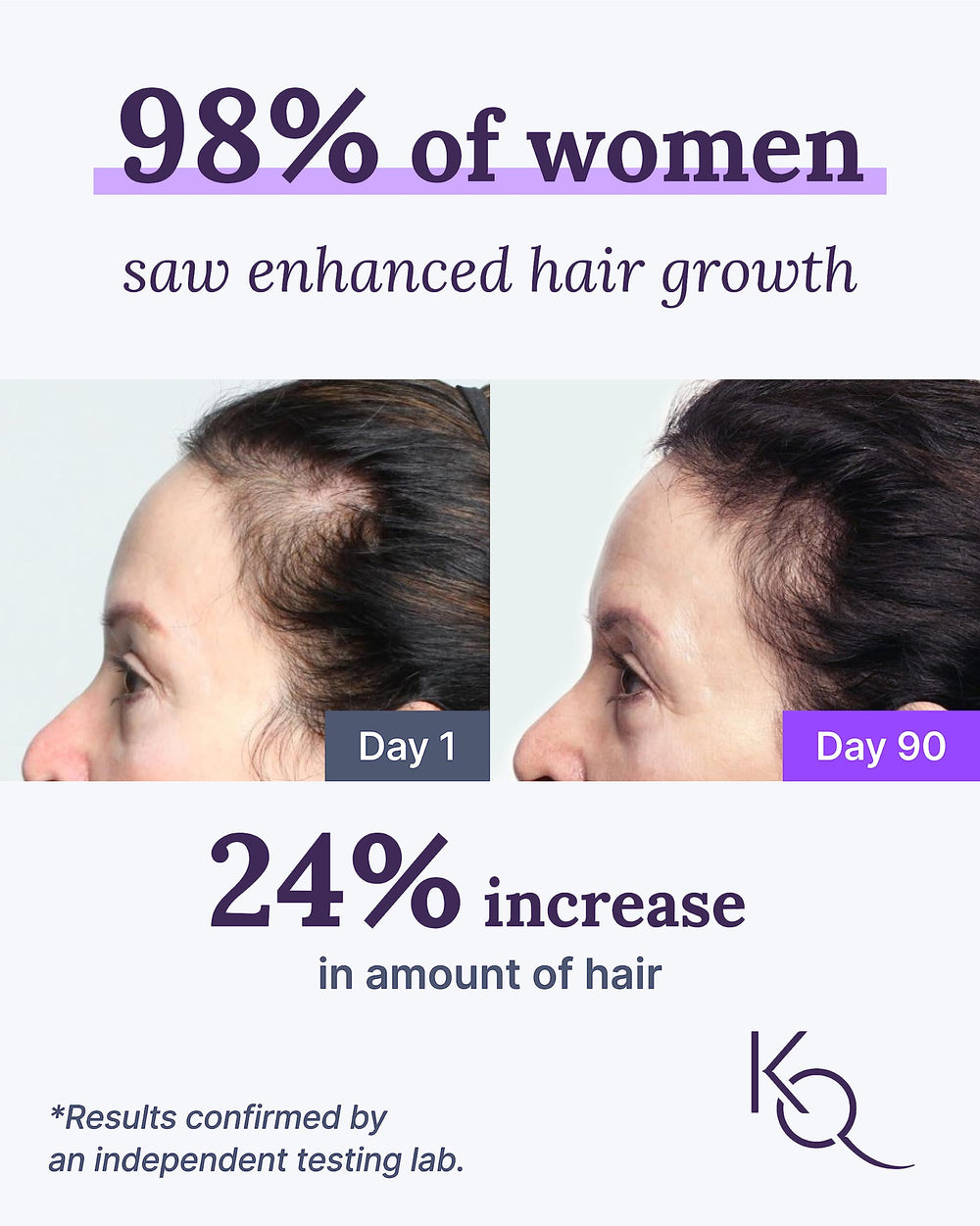 Keranique Hair & Scalp Supplements daily dose two capsules per day visual