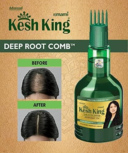 KESH KING 50ml packaging displayed for everyday routine.