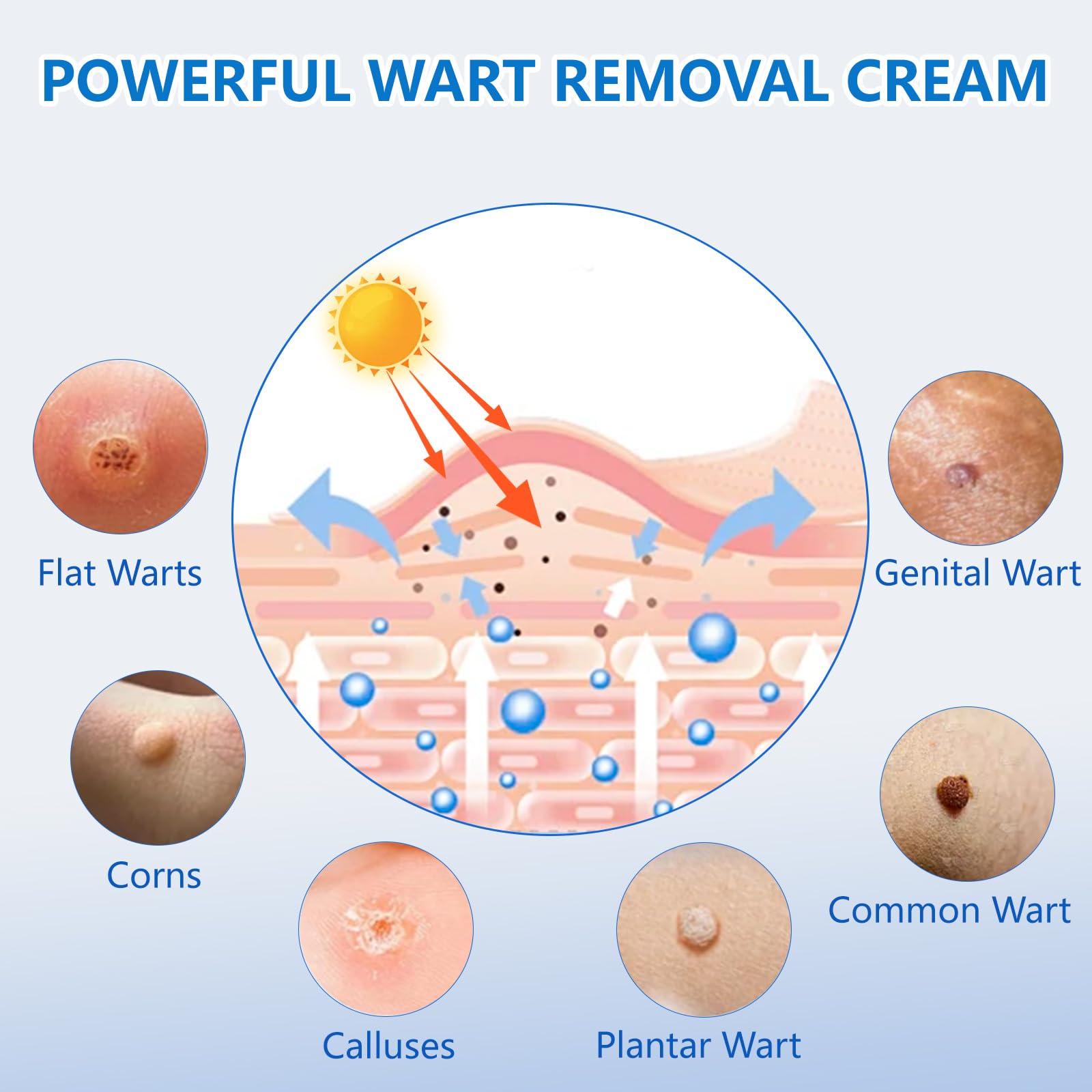 KIbabyDI Wart Remover Freezing Therapy Tube for precise wart treatment
