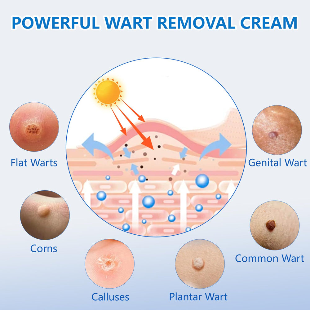 KIbabyDI Wart Remover Freezing Therapy Tube for precise wart treatment