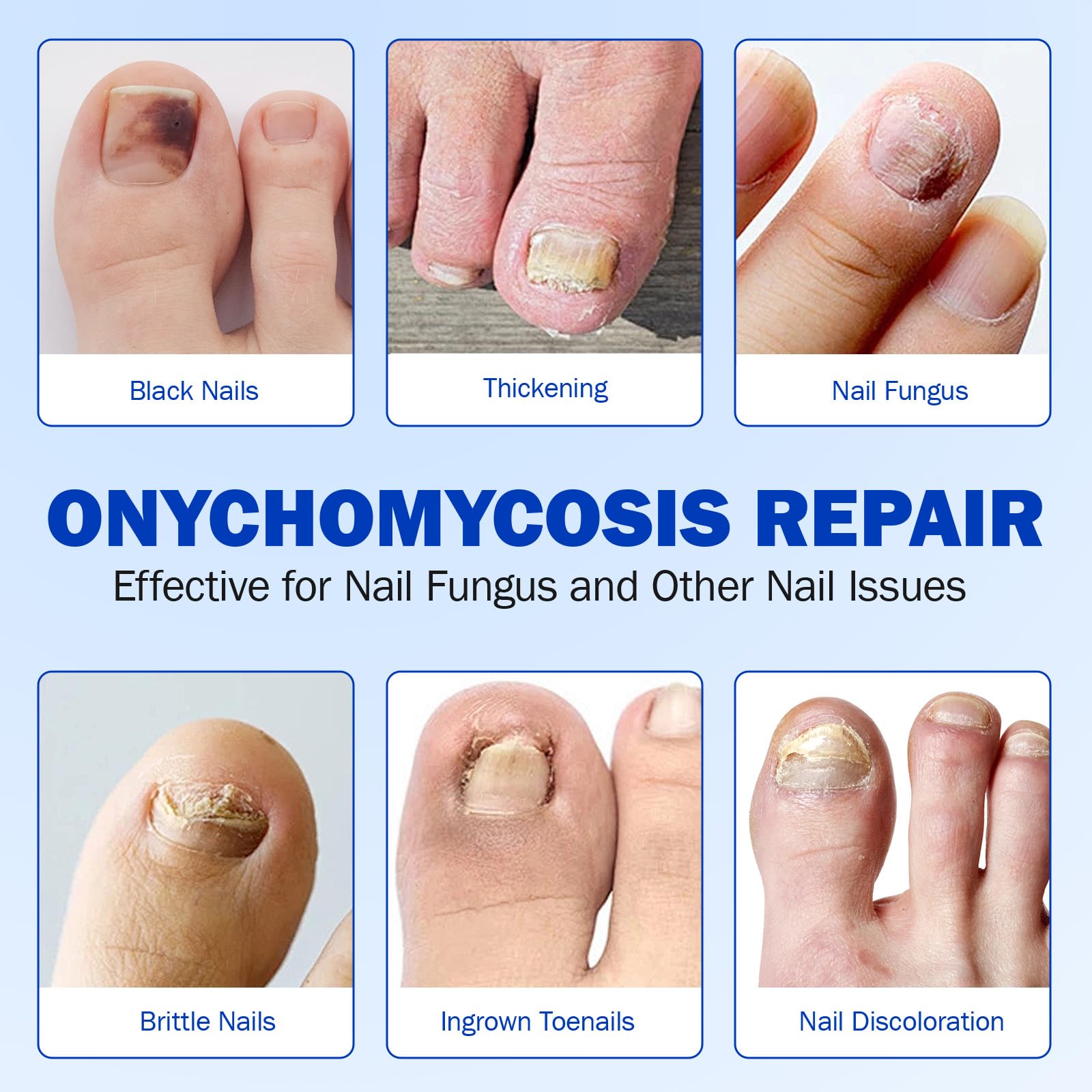 KITNOBLIS healthy nail growth emerging on nails