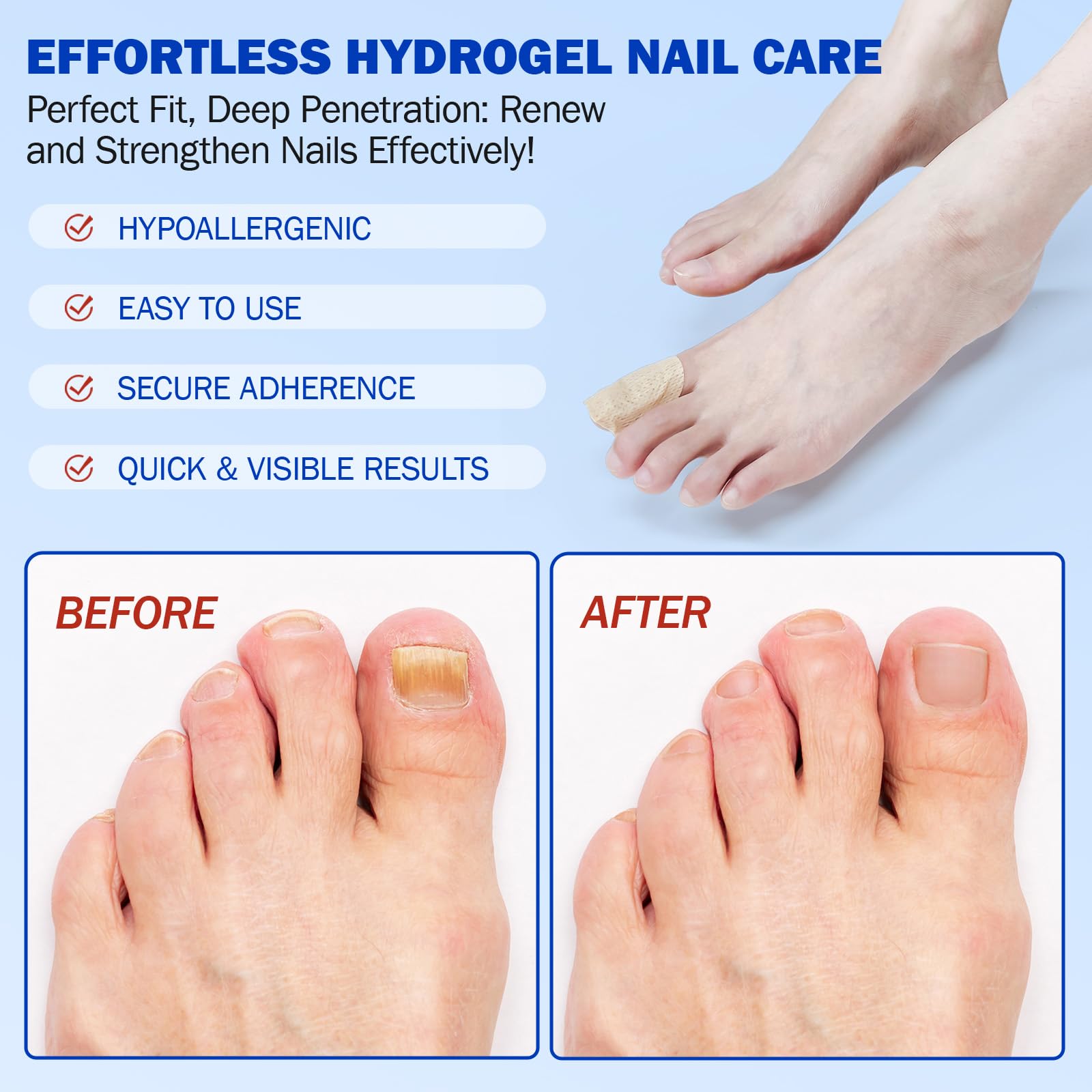 KITNOBLIS softening thick nails close-up signals easier trimming