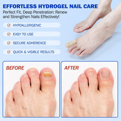 KITNOBLIS softening thick nails close-up signals easier trimming