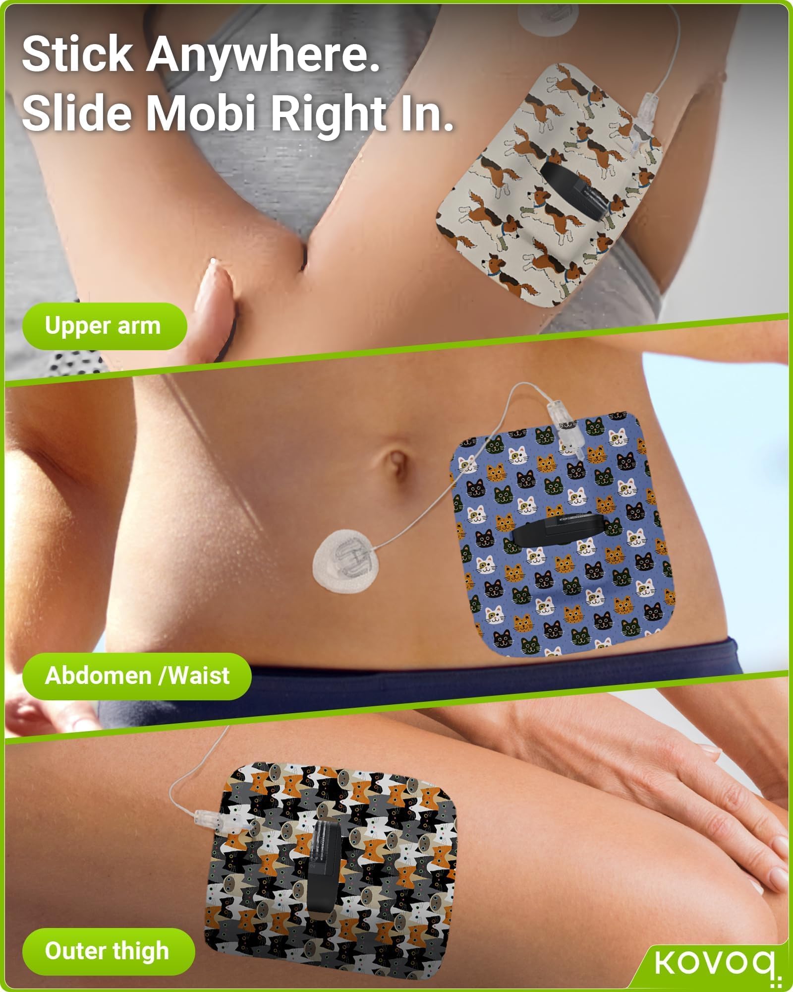 KOVOQ adhesive sleeve uses fray-resistant 4-way stretch fabric for durability and fit.