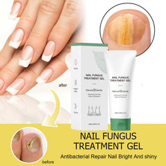 KUNLEN Nail Growth Gel hydrates nails and adds natural shine