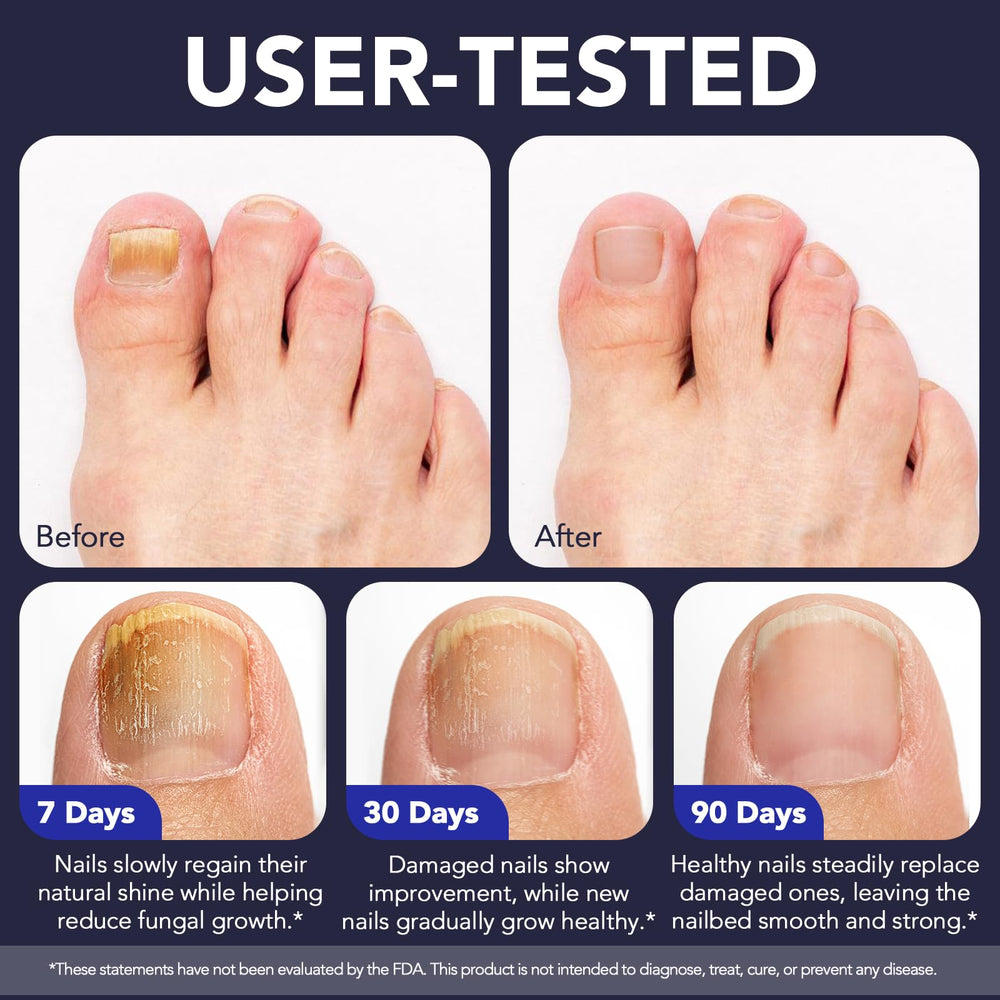 KZUO Clove Bud Oil enhances the blend and soothes affected nails.