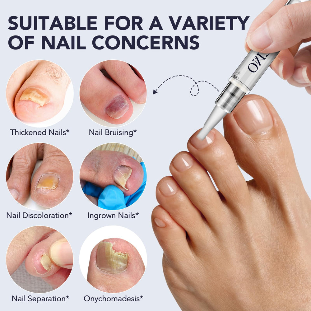 KZUO Extra-Strength 25 Undecylenic Acid Formula targets stubborn fungus for healthier-looking nails.