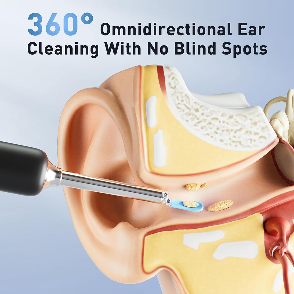 Lebbtl ear-cleaning-kit-7pcs includes versatile tools for thorough maintenance.