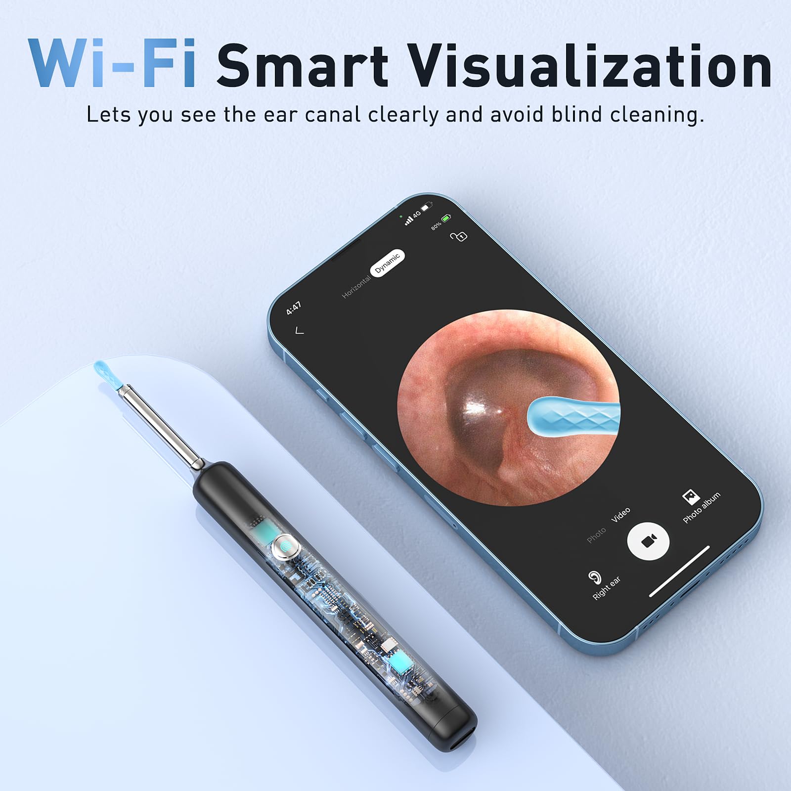 Lebbtl ear-kit-7-pcs-otoscope-set includes multiple tips for customization.