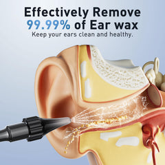 Lebbtl four-pressure-modes-ear-cleaner offering adjustable control for comfortable use.