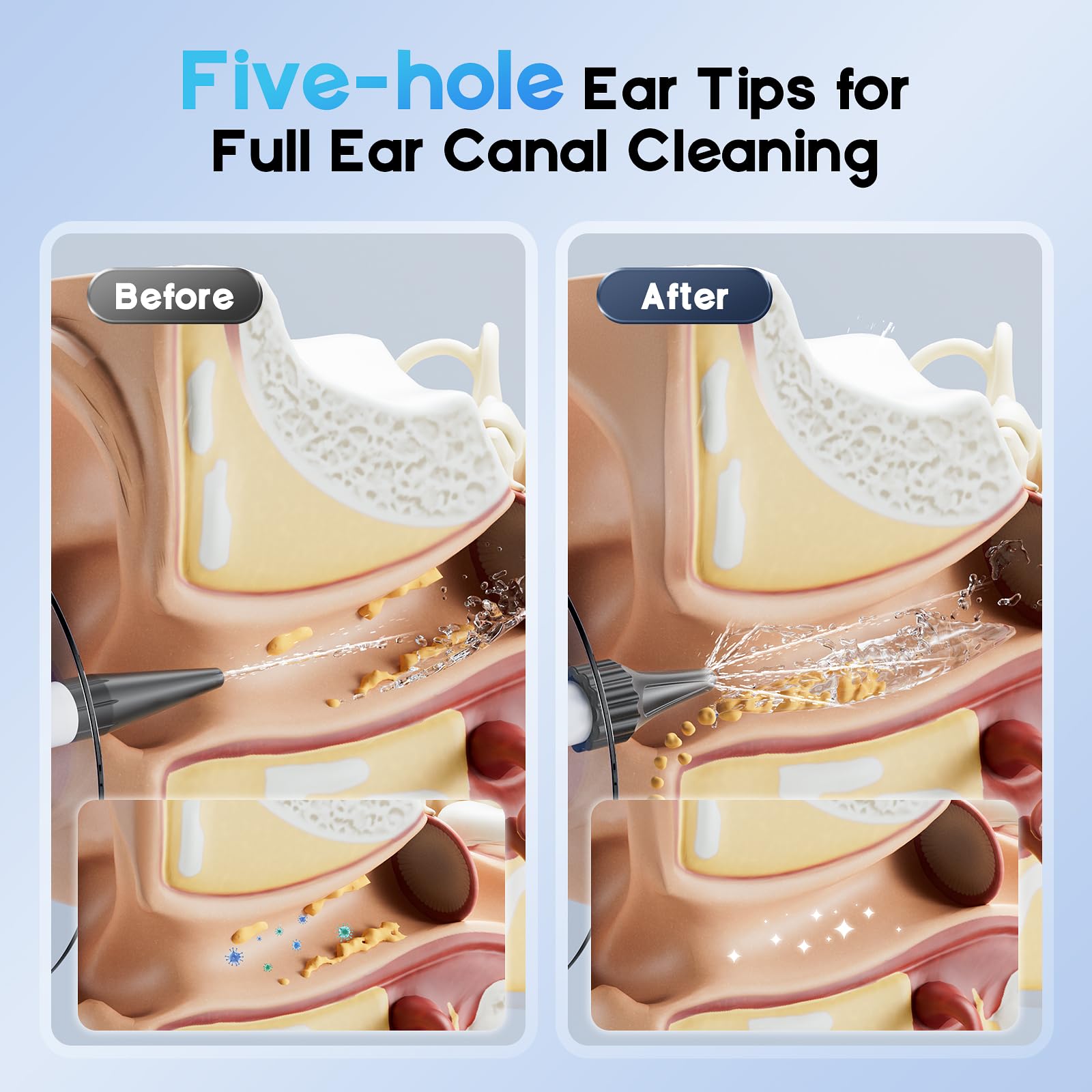 Lebbtl Single-hole ear tips close-up showing targeted cleaning capability.