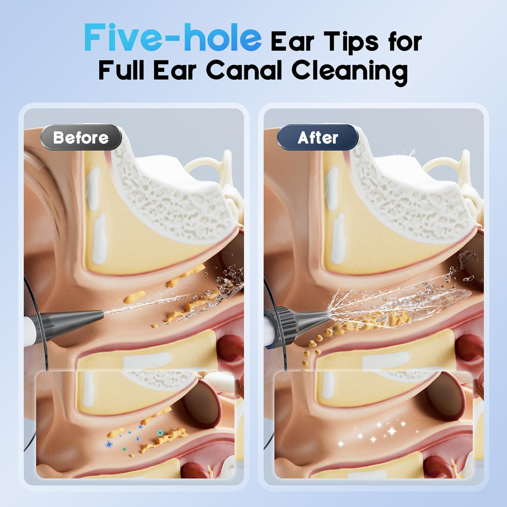 Lebbtl Single-hole ear tips close-up showing targeted cleaning capability.