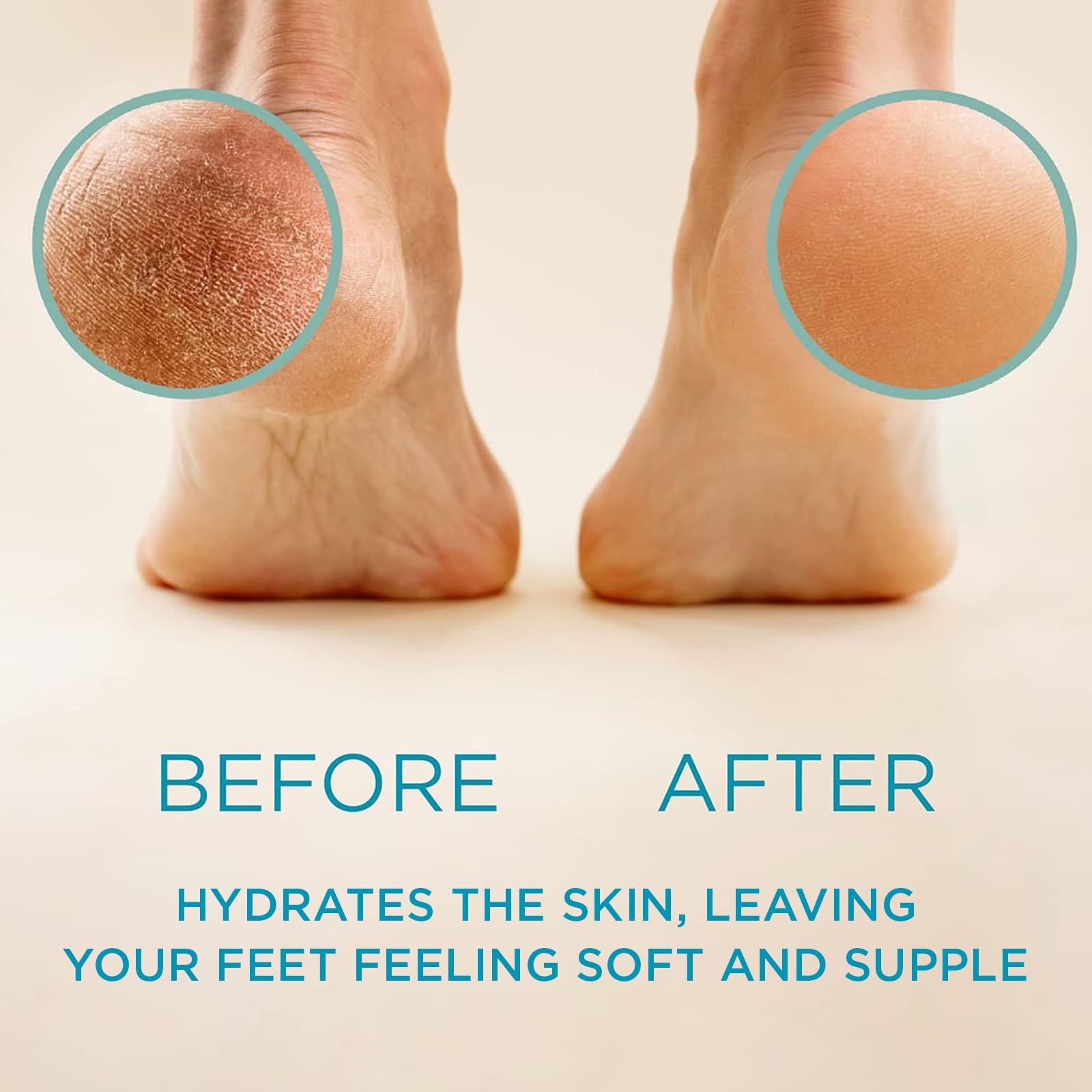 Lee Beauty Pro gel remover targets cracked heels for a more comfortable foot.