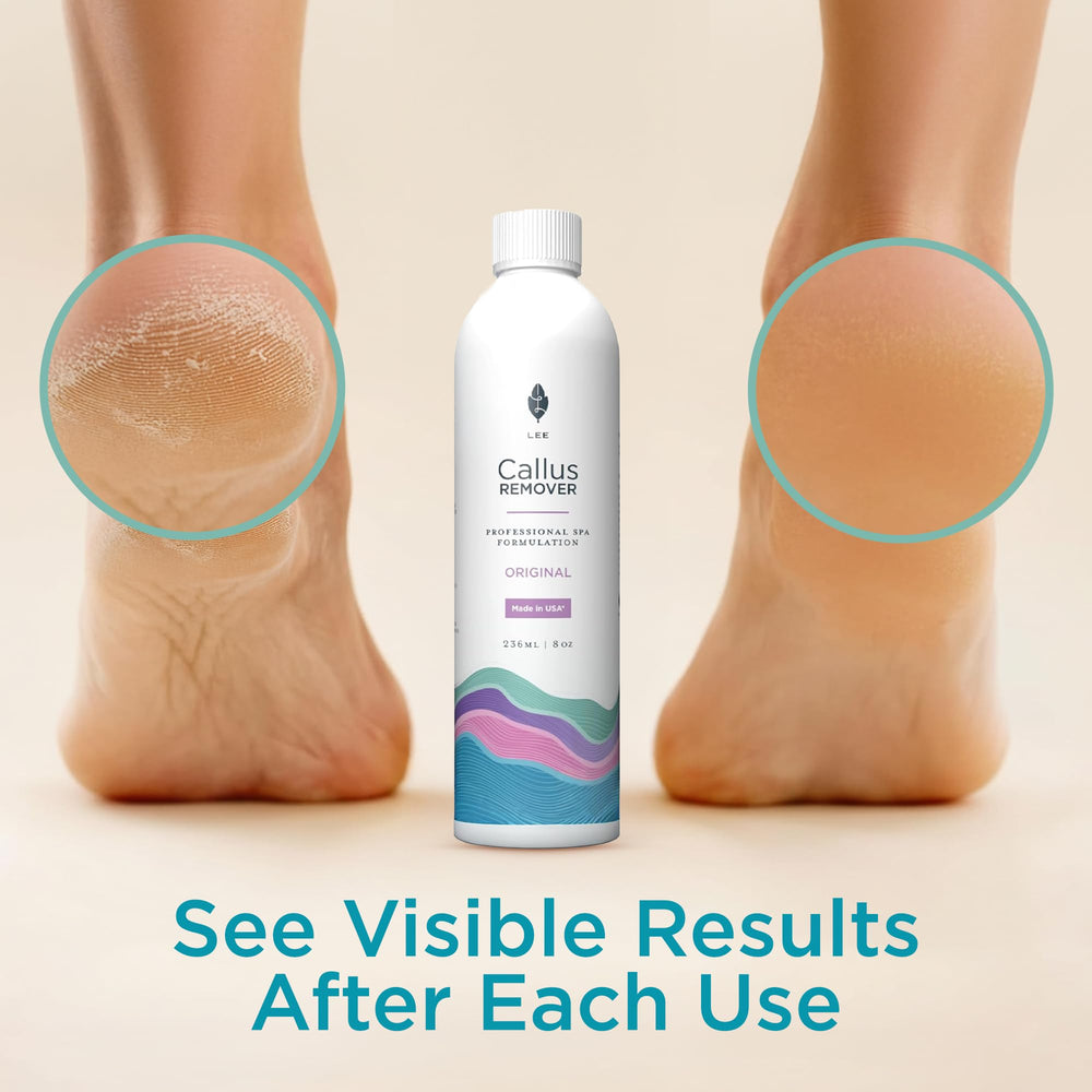 Gel being applied for a quick 3–7 minute treatment.