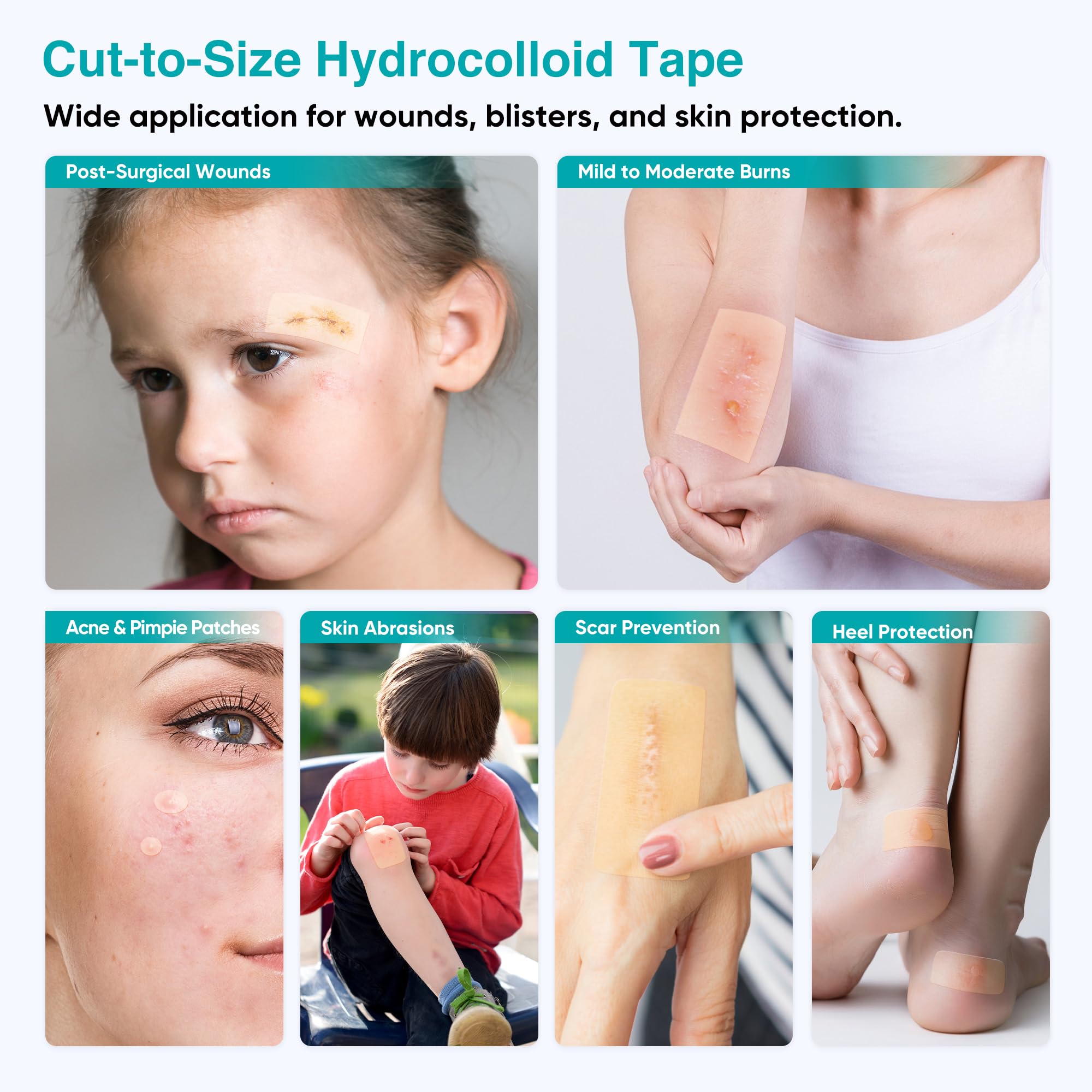 LinToButy hydrocolloid roll protecting elbows and knees during movement
