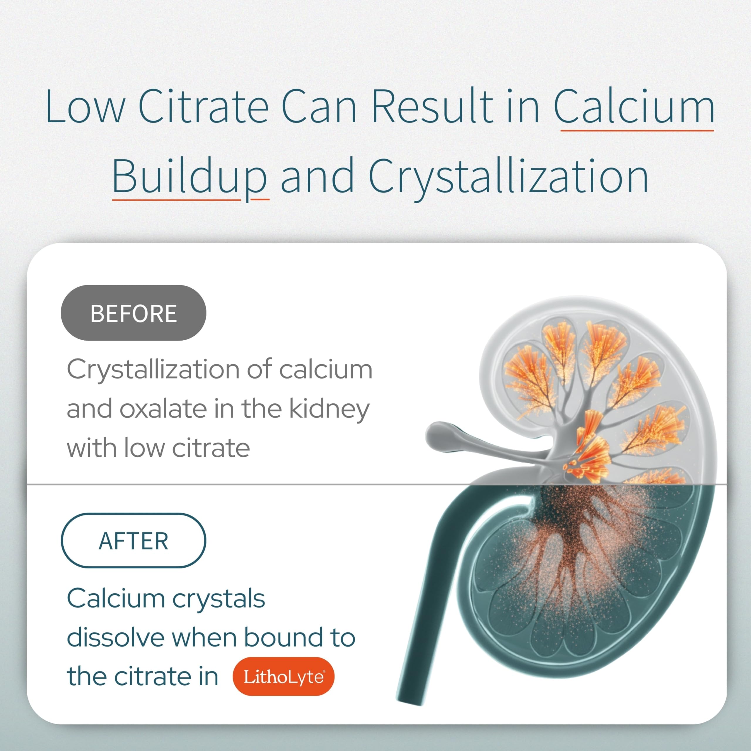 LithoLyte developed by urologists for citrate balance support.