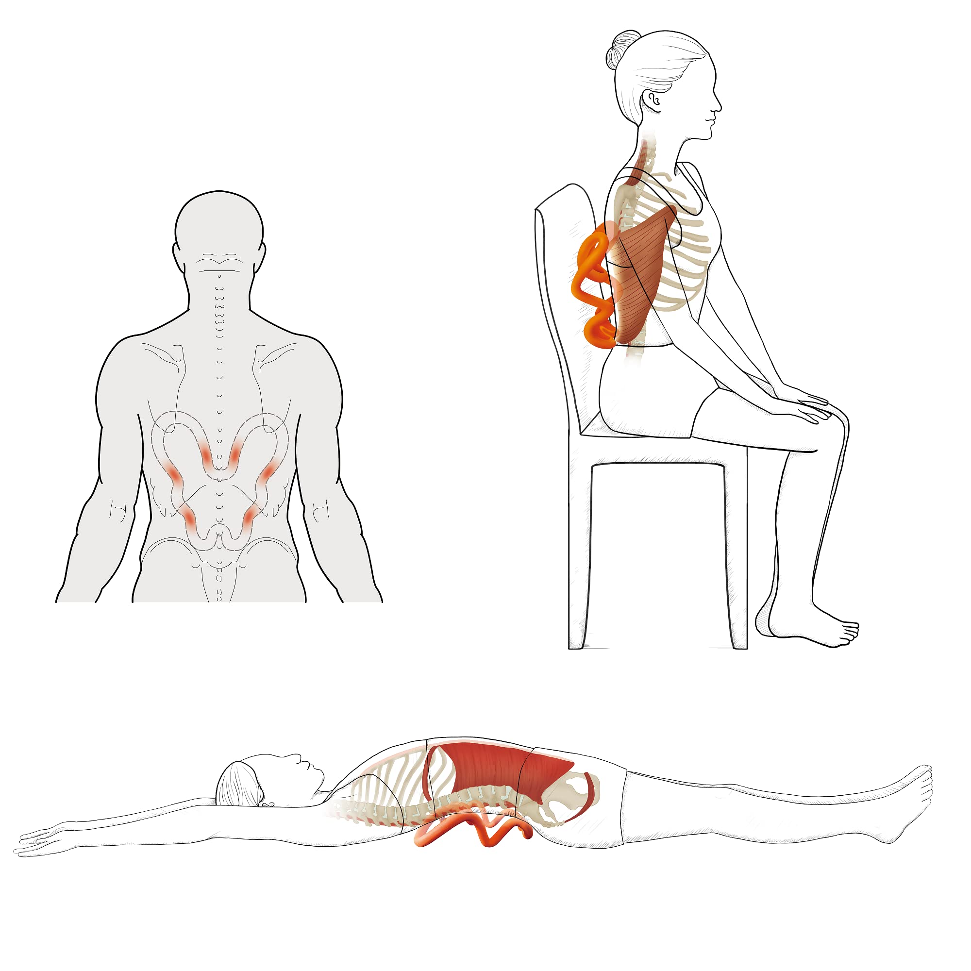LittleMum tool targets the levator scapulae for knot relief