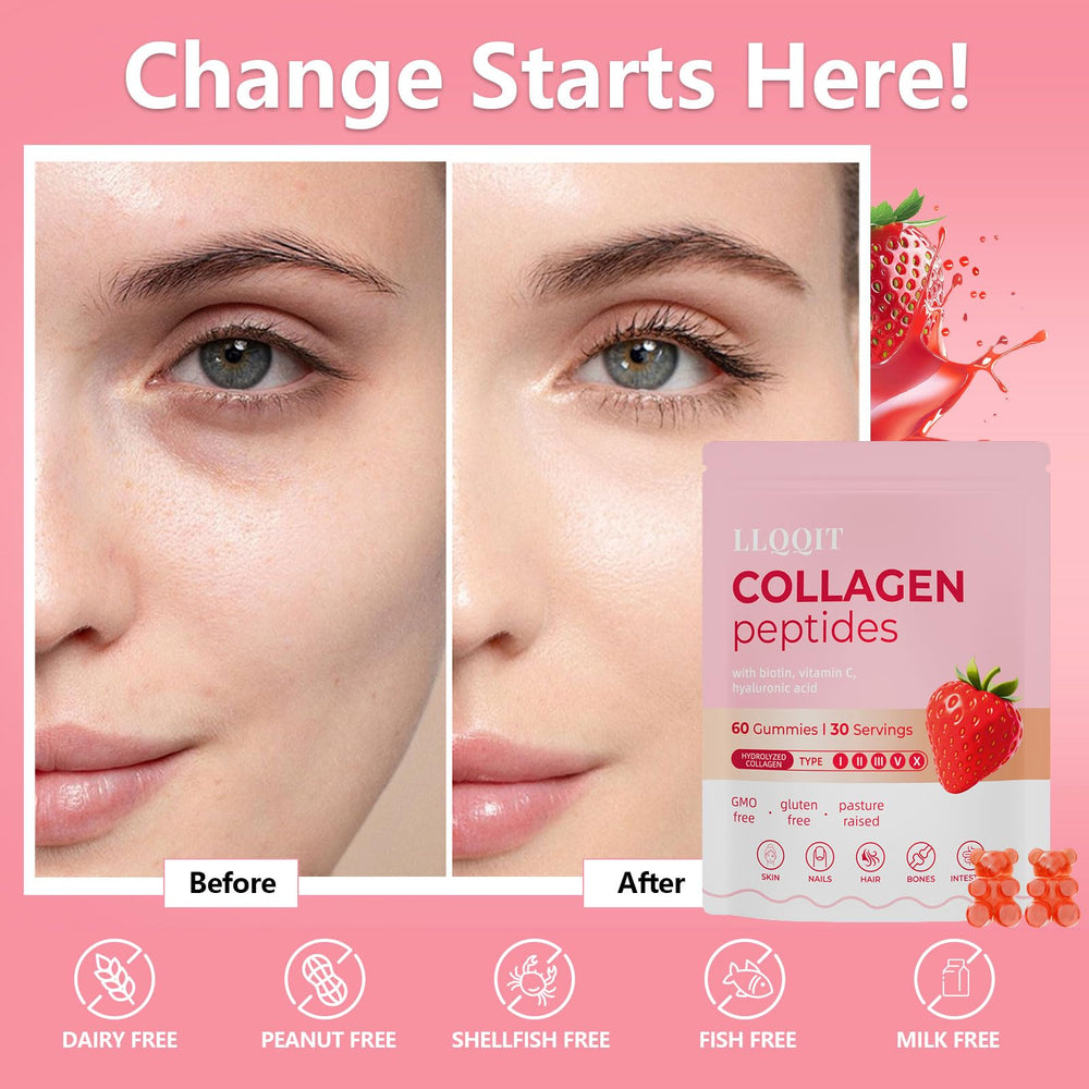 LLQQIT collagen gummies on-the-go packaging for busy days