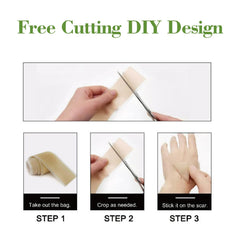 LOSVEO cut-to-fit edges adapting to different scar shapes.