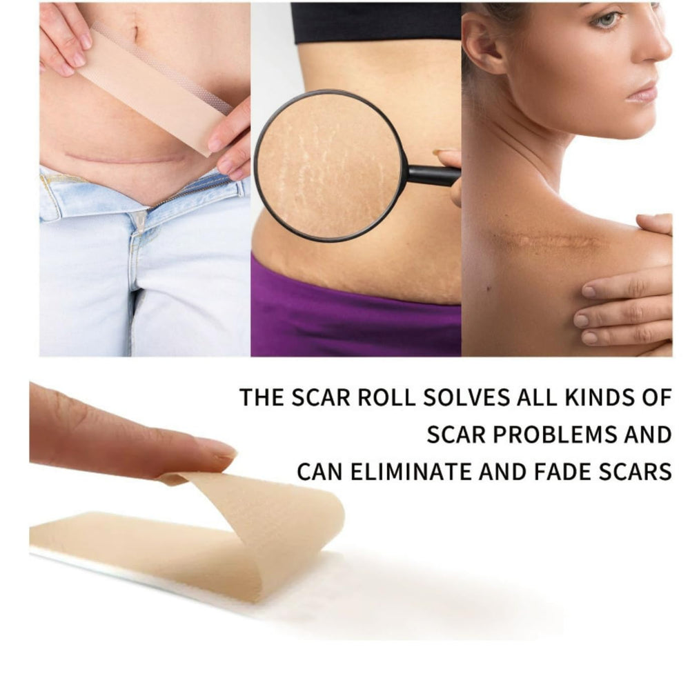 LOSVEO reusable scar sheets, wash and reuse for ongoing use.