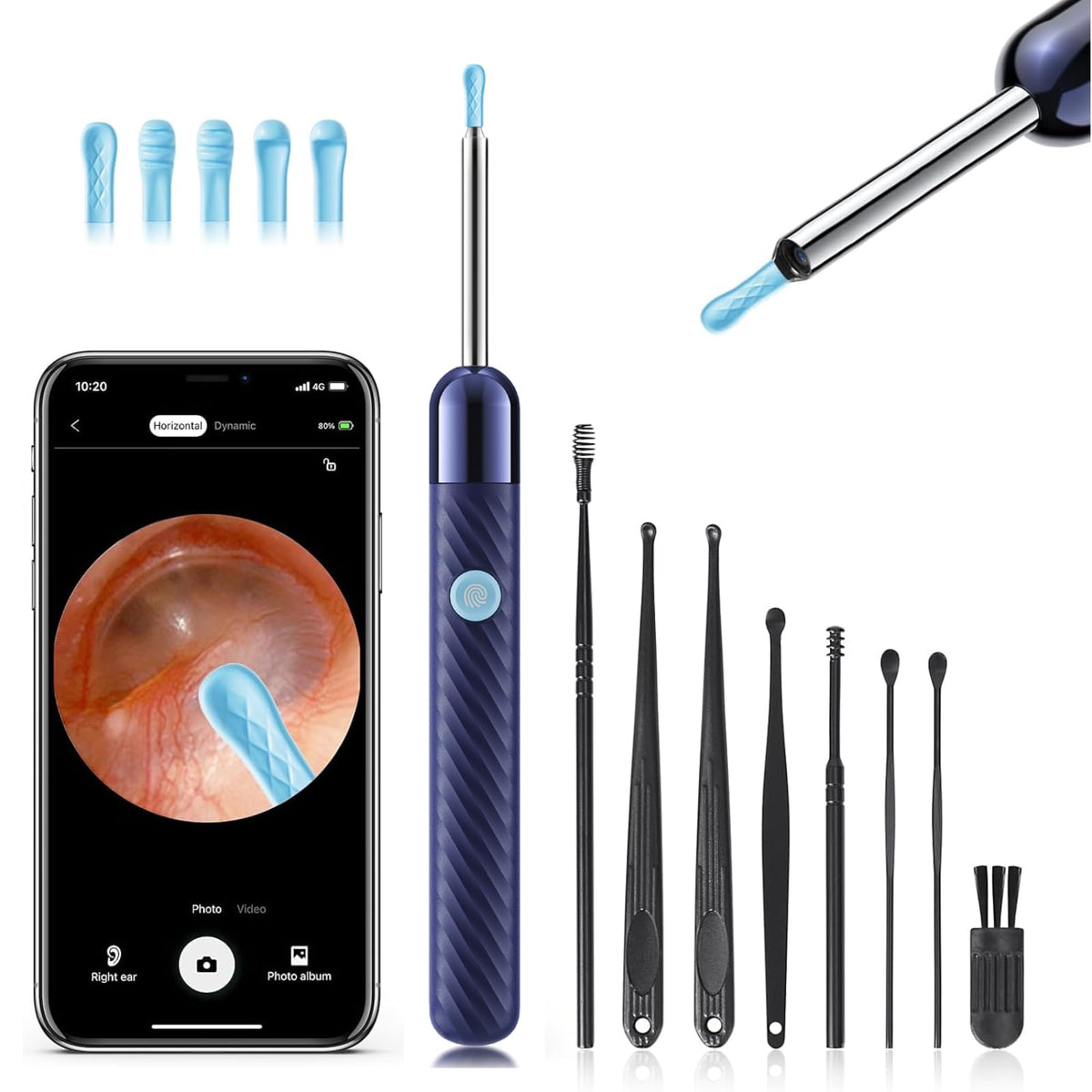 Loyker ear wax removal camera with 360° view for clear ear inspection.