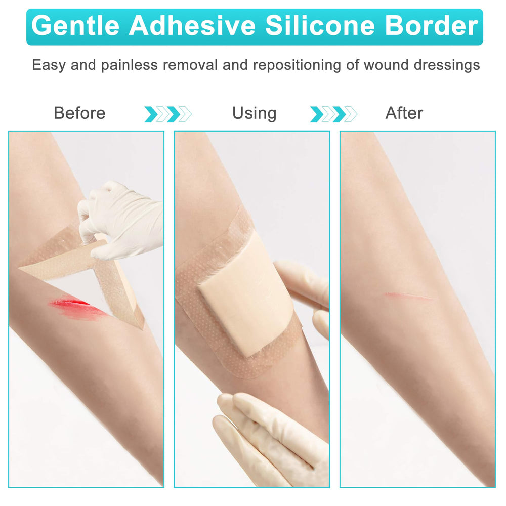 Application on a bedsores area, showcasing secure border adhesion.