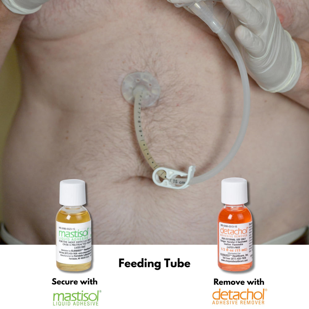Latex-free Mastisol label signals skin-friendly formulation for careful application.