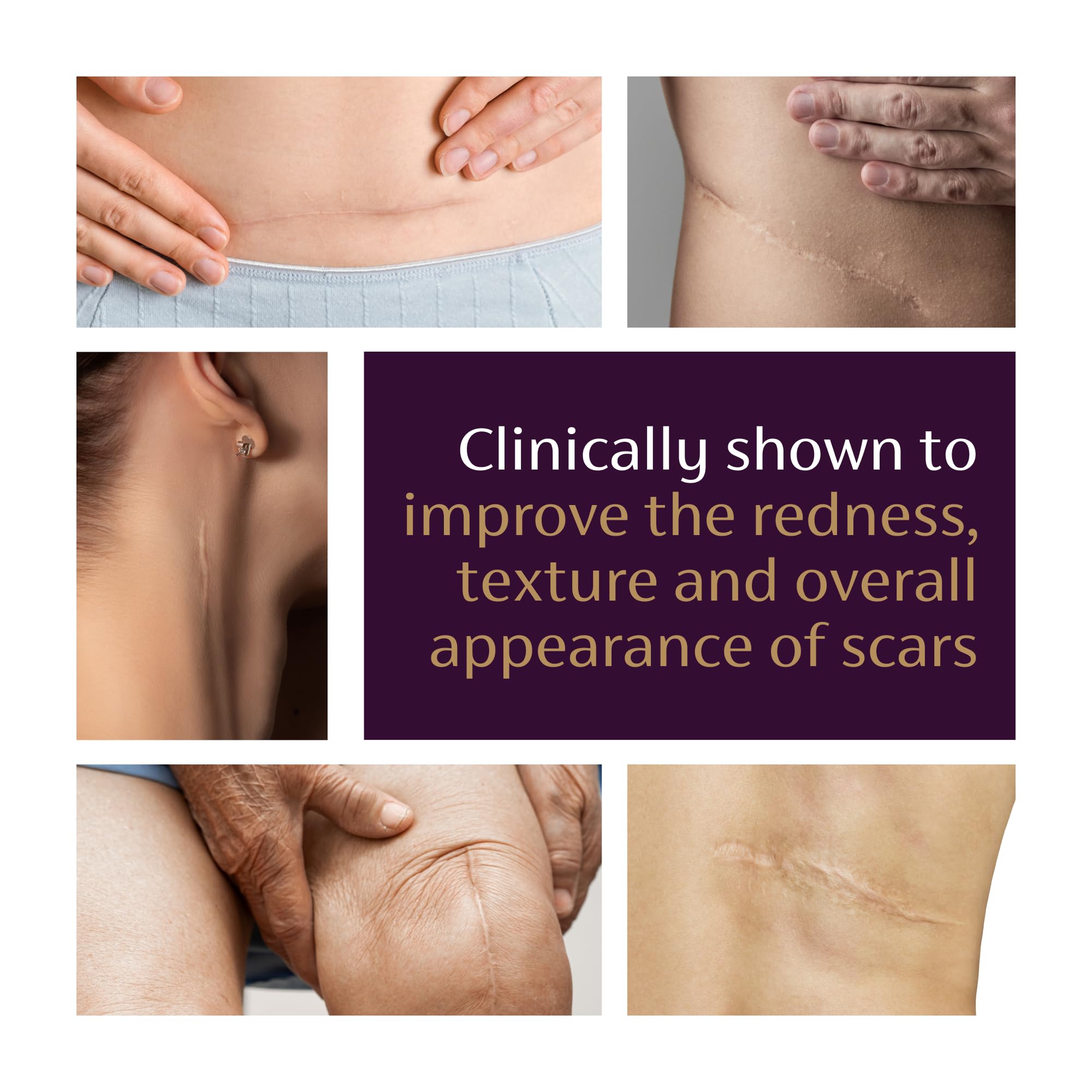Label details of Mederma Advanced Scar Gel emphasizing trusted scar care