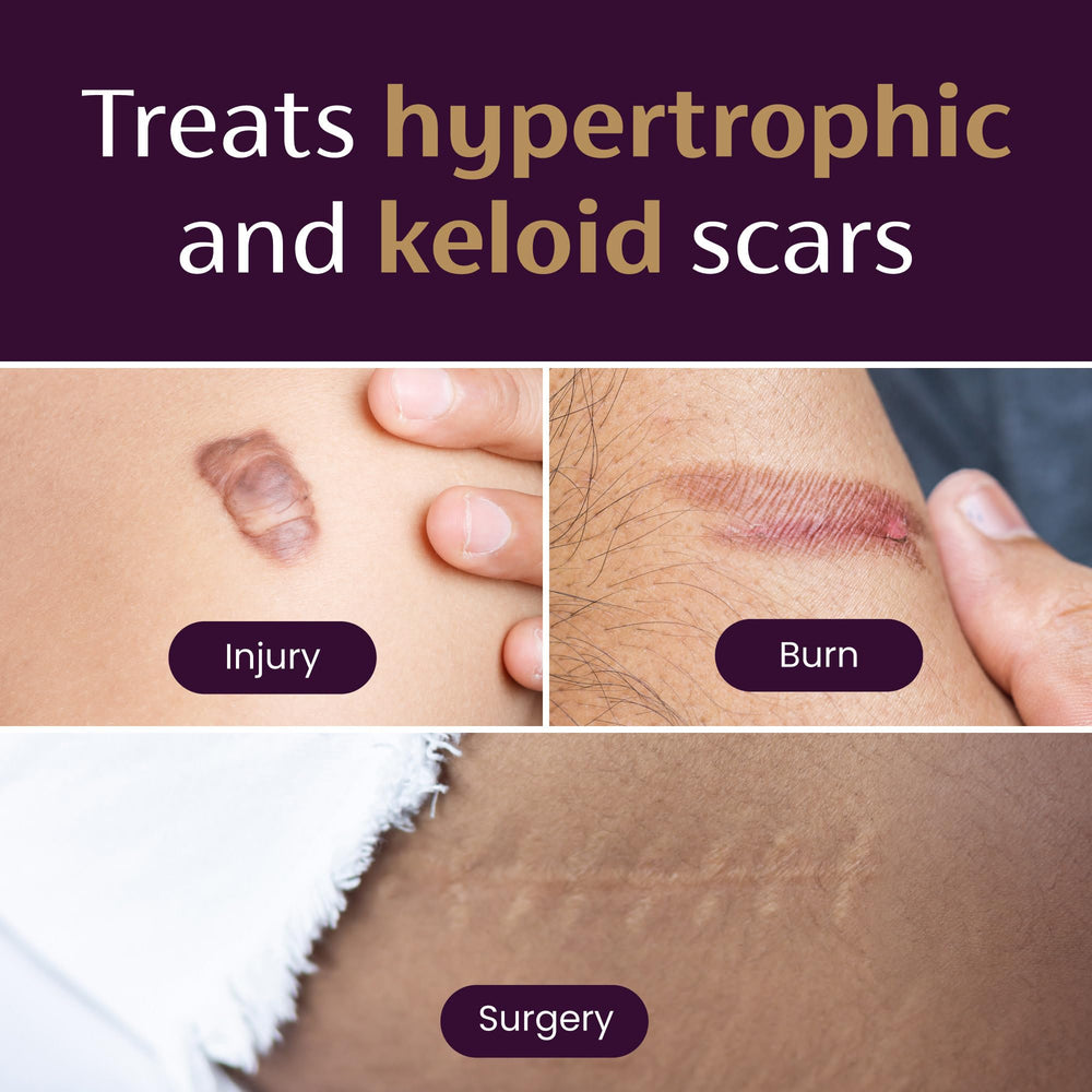 Mederma silicone scar sheet flexible design shown on skin