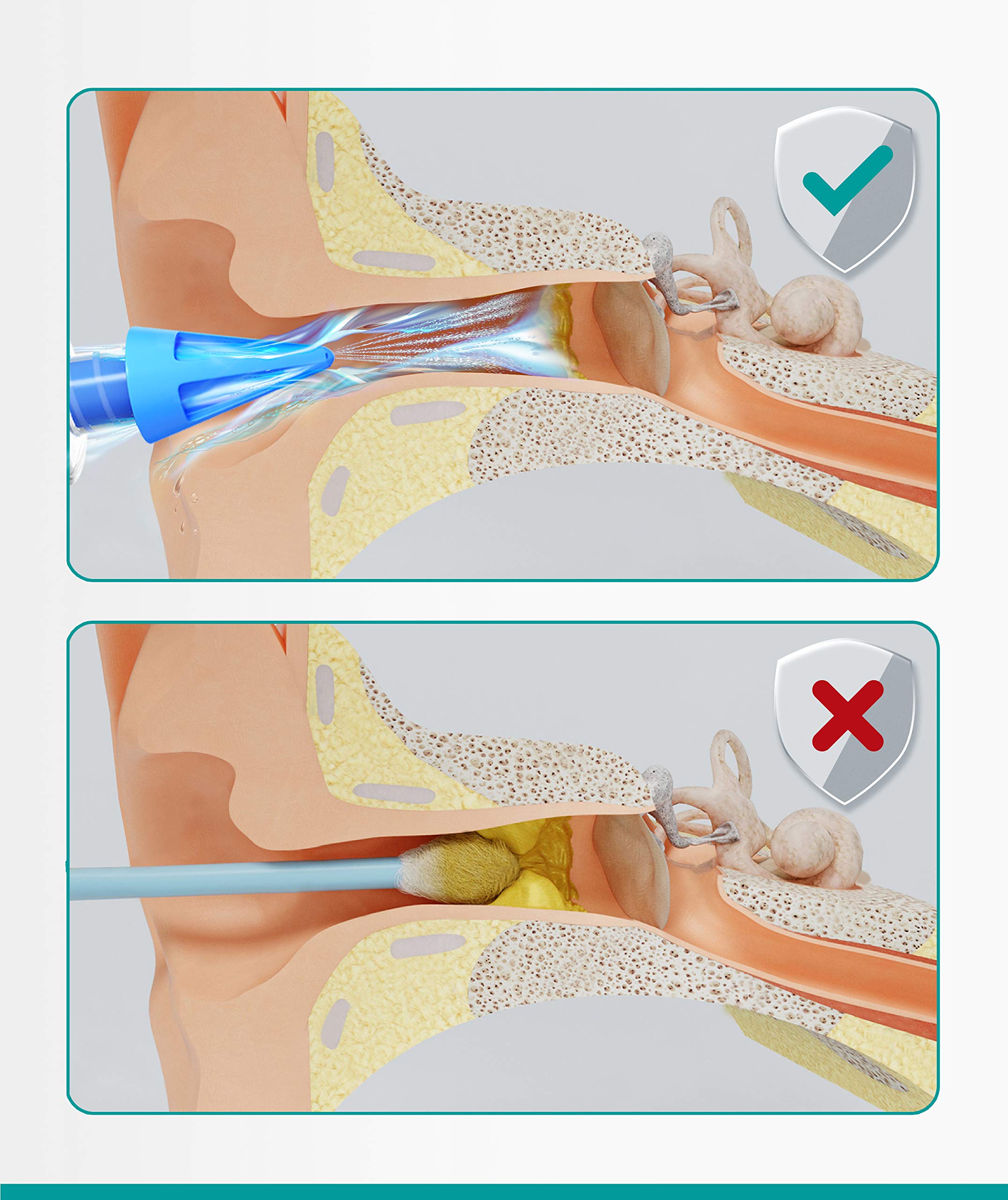 Medi Grade ear syringe safety features ensure comfortable hygiene sessions.