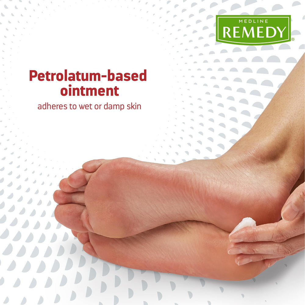 Medline Remedy 2% Miconazole Nitrate formula shown for infection management