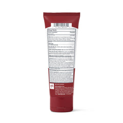 Medline Remedy Clinical Antifungal Cream tube close-up showing application for skin relief.