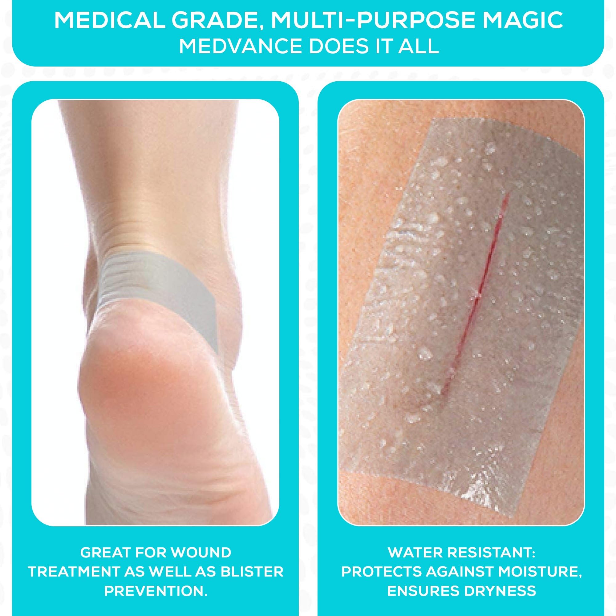 MedVance silicone tape used on blisters for protection and comfort.