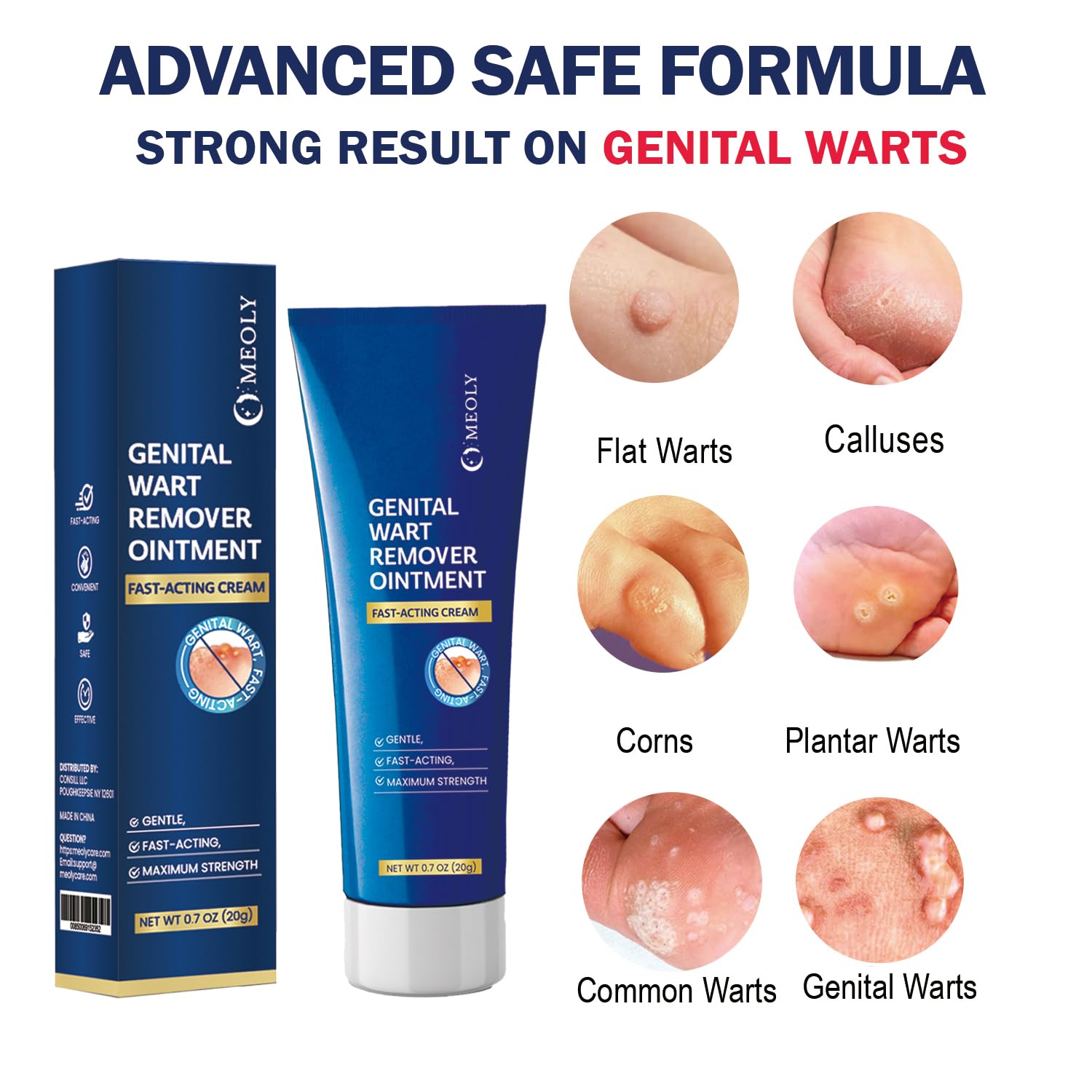 MEOLY Genital Wart Remover Cream applicator for precise application.