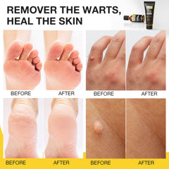 MEOLY application tip enables precise placement on affected skin