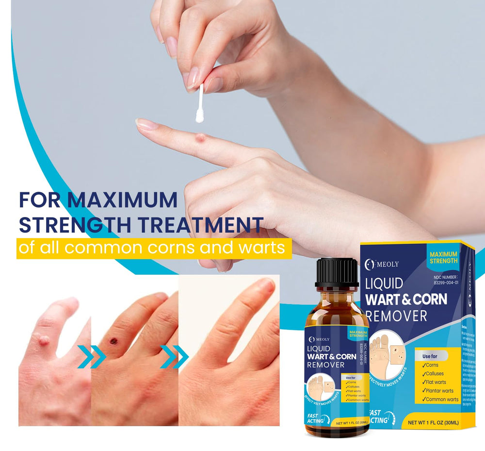 MEOLY plantar wart treatment for feet soothes rough skin.