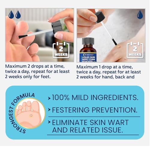 MEOLY Wart Remover brand logo closeup reinforces trusted product identity.