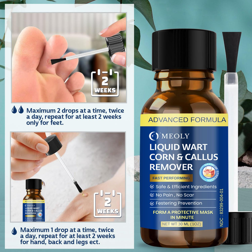 MEOLY formula applied to a corn or callus surface for smoother skin.