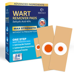 Meoly wart remover pad applied to a toe for targeted plantar wart treatment