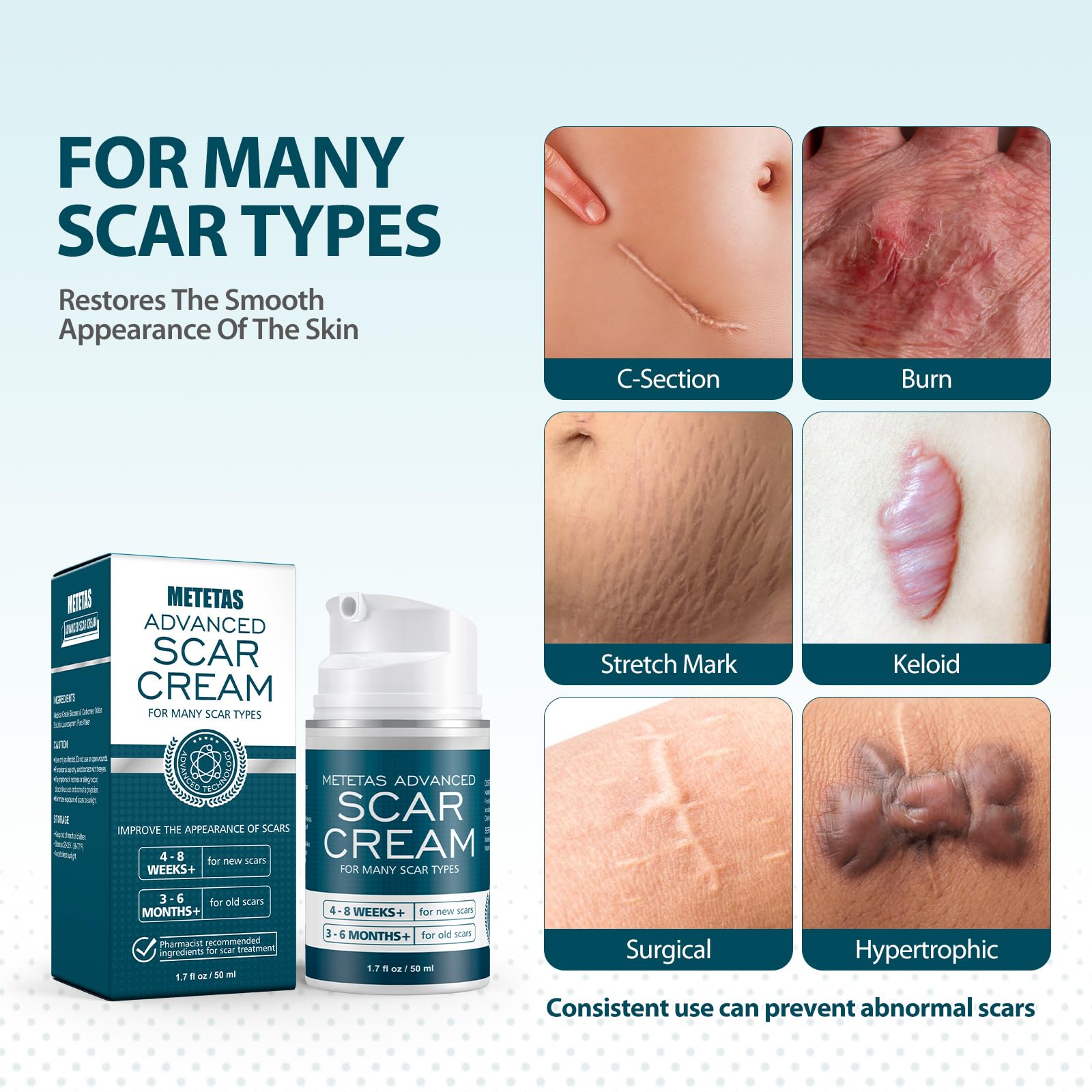 Ingredient-closeup of Metetas scar gel emphasizing natural components