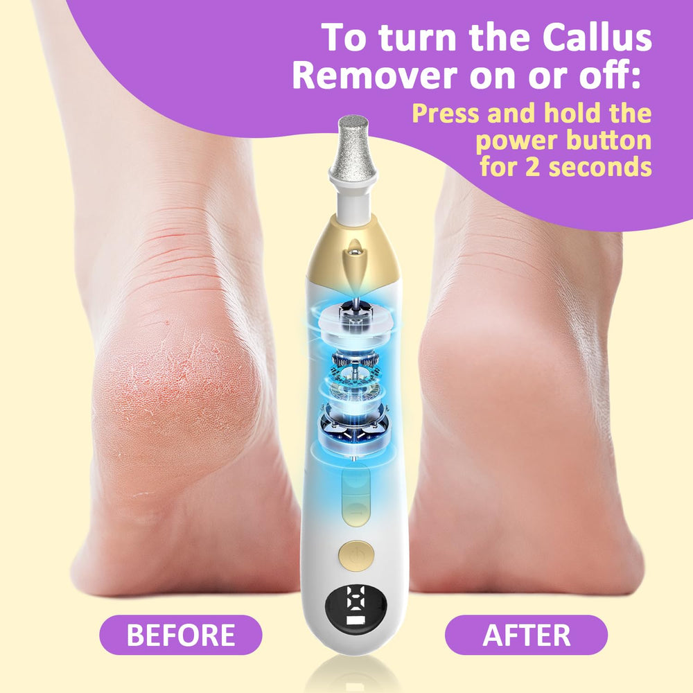 MFish Callus Remover 9 speeds dial enables precise control for different skin areas